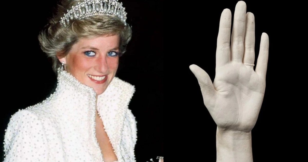 Gips Ruka 37-godišnja gipsana ruka princeze Dajane mogla bi da dobije 45.000 ...